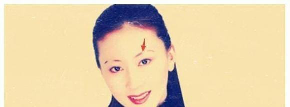 9 kieu long may xau nhat, anh huong den tuong mao va pha tai-Hinh-5