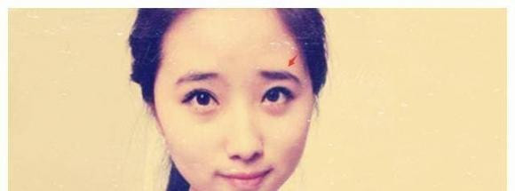 9 kieu long may xau nhat, anh huong den tuong mao va pha tai-Hinh-6