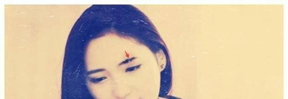 9 kieu long may xau nhat, anh huong den tuong mao va pha tai-Hinh-7