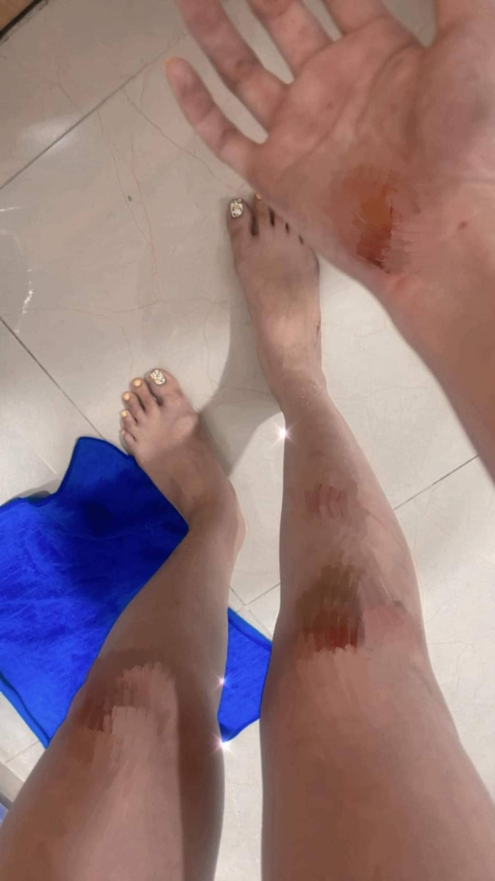 Hoa hau Diem Huong gap phai su co giao thong khien nhieu nguoi lo lang-Hinh-6