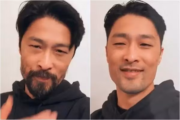 Johnny Tri Nguyen lai xau di sau hon 1 thang tut tat ngoai hinh