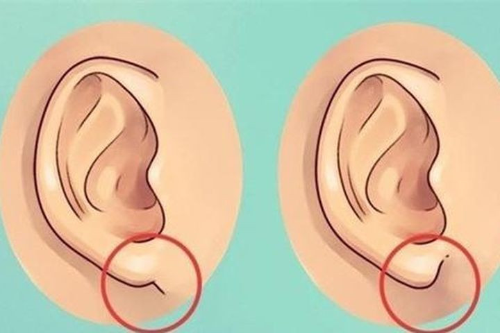 Nếu là người có đôi tai ngắn, dái tai mỏng thì đa số những người này từ nhỏ đã có thể chất kém, dễ mắc bệnh tật, trí tuệ kém, làm việc gì cũng thiếu suy nghĩ, ý chí kém cỏi, khi gặp khó khăn thoái lui trốn tránh, sự nghiệp khó có phát triển tốt, dù bận rộn cả đời cũng không làm được gì, cuộc sống càng thêm khó khăn!