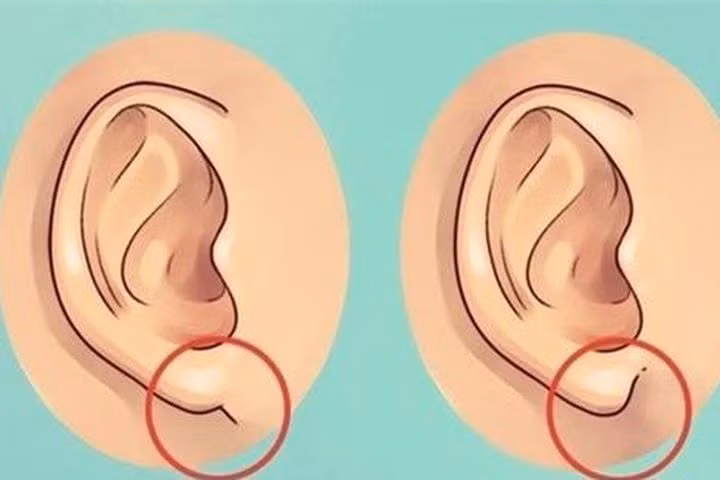 Nếu là người có đôi tai ngắn, dái tai mỏng thì đa số những người này từ nhỏ đã có thể chất kém, dễ mắc bệnh tật, trí tuệ kém, làm việc gì cũng thiếu suy nghĩ, ý chí kém cỏi, khi gặp khó khăn thoái lui trốn tránh, sự nghiệp khó có phát triển tốt, dù bận rộn cả đời cũng không làm được gì, cuộc sống càng thêm khó khăn!