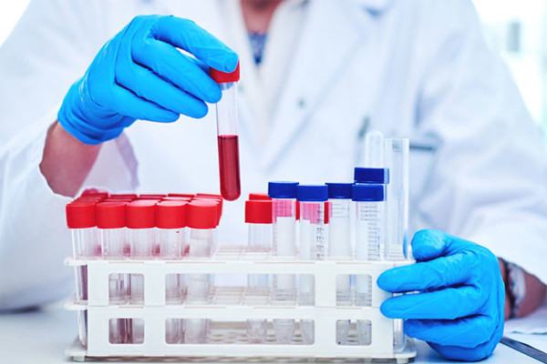 Mối liên hệ giữa nhóm máu và nguy cơ mắc 4 bệnh nguy hiểm - Hình 2 Moi lien he giua nhom mau va nguy co mac 4 benh nguy hiem-Hinh-2