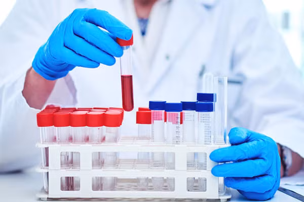 Moi lien he giua nhom mau va nguy co mac 4 benh nguy hiem-Hinh-2