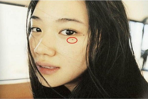 5 nốt ruồi phá tướng, rước thị phi, làm công danh lao đao - Hình 4 5 not ruoi pha tuong, ruoc thi phi, lam cong danh lao dao-Hinh-4