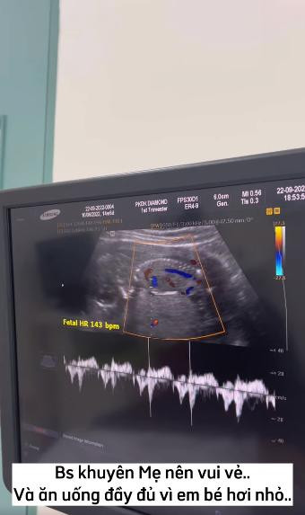 Chuan bi sinh con cho tomboy Bi Bao, Mui Xu lo anh khoc nuc no-Hinh-4