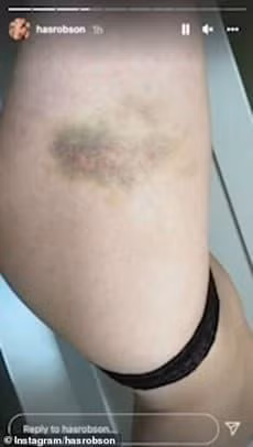 Ban gai sieu sao Manchester United dang video bi bao hanh mau me bam tim-Hinh-3