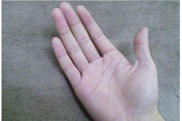 ##b###Người có ngón trỏ và ngón đeo nhẫn dài bằng nhau gặp nhiều may mắn Ngón trỏ và ngón đeo nhẫn có độ dài bằng nhau hoặc khoảng cách rất nhỏ cho thấy đây là người thông minh, kỷ luật, có tài. Họ có thể dựa vào năng lực của bản thân để dũng cảm tiến về phía trước trên đường đời, vận khí ngày càng khởi sắc. Ngoài ra, người có đường chỉ tay này gặp nhiều may mắn về tài chính, sau 35 tuổi có thể công danh, phát triển sự nghiệp, phú quý.