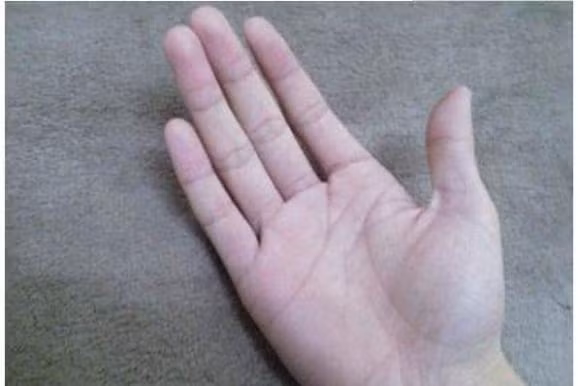  Người có ngón trỏ và ngón đeo nhẫn dài bằng nhau gặp nhiều may mắn Ngón trỏ và ngón đeo nhẫn có độ dài bằng nhau hoặc khoảng cách rất nhỏ cho thấy đây là người thông minh, kỷ luật, có tài. Họ có thể dựa vào năng lực của bản thân để dũng cảm tiến về phía trước trên đường đời, vận khí ngày càng khởi sắc. Ngoài ra, người có đường chỉ tay này gặp nhiều may mắn về tài chính, sau 35 tuổi có thể công danh, phát triển sự nghiệp, phú quý.