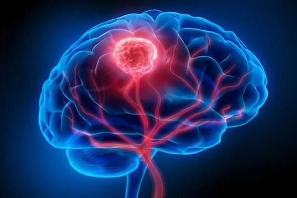 Tu y bo sung loai vitamin nay, coi chung ung thu di can nao