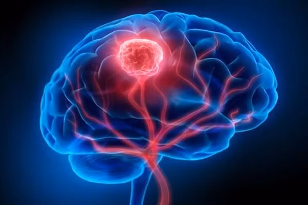 Tu y bo sung loai vitamin nay, coi chung ung thu di can nao