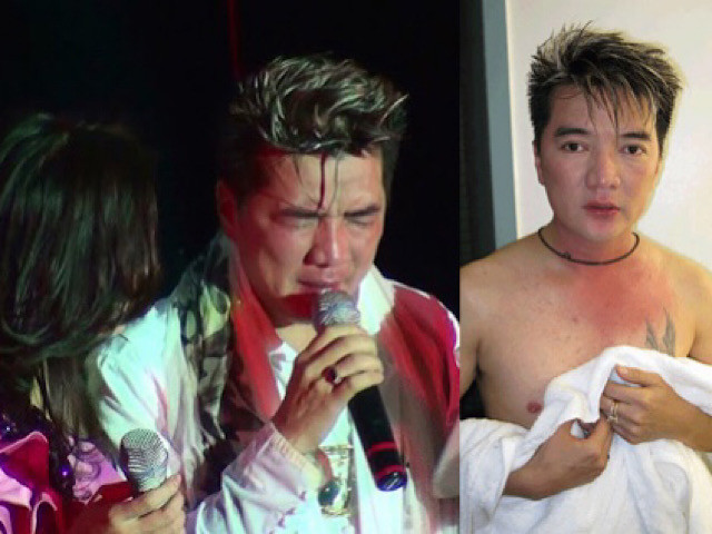 Ca si bi hanh hung, danh hoi dong khi di hat-Hinh-3