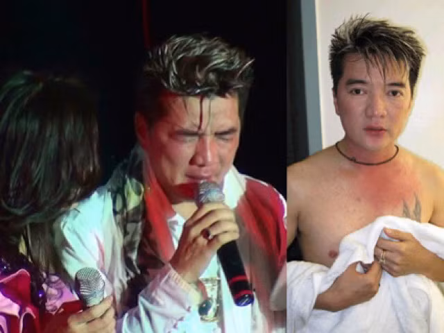 Ca si bi hanh hung, danh hoi dong khi di hat-Hinh-3