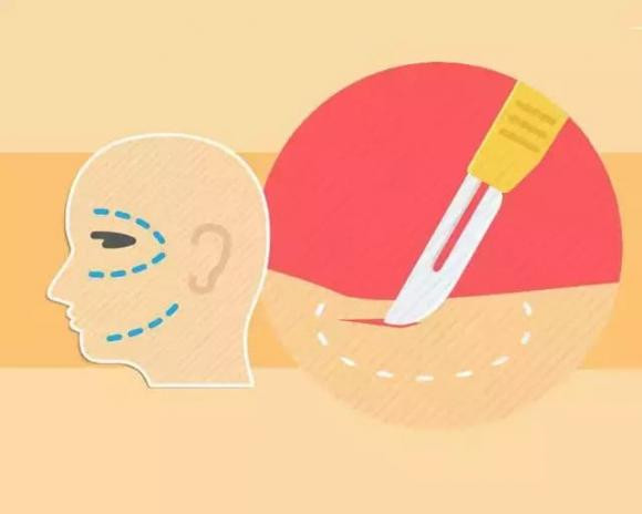 Tai sao vung da bi rach khong bi chay mau khi phau thuat?-Hinh-5