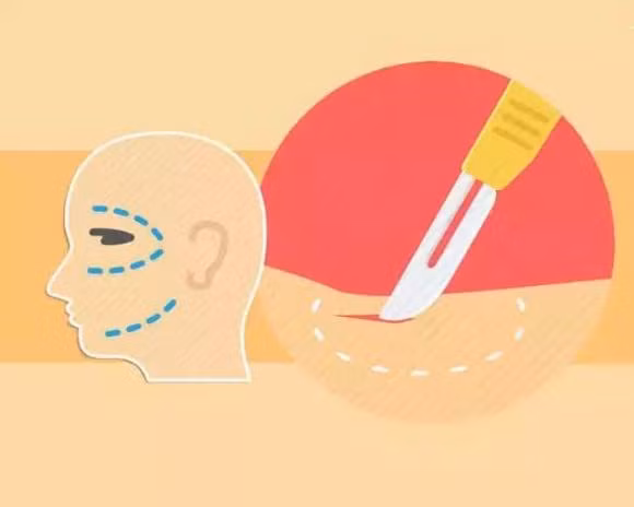 Tai sao vung da bi rach khong bi chay mau khi phau thuat?-Hinh-5