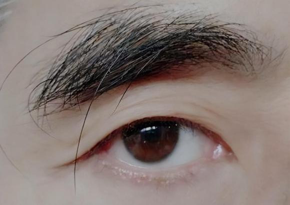 Lông mày càng dài càng tốt, đối với người trẻ và trung niên có thể do bệnh tật, đối với nam giới sau 50 tuổi đừng nghĩ rằng mình là người sống lâu chỉ vì để lông mày dài. Cần hình thành những thói quen tốt. Nếu phát hiện những thay đổi bất thường ở lông mày, bạn cũng nên cảnh giác.