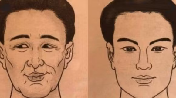 Miệng cong vẹo. Bộ phận miệng nói đối với con người thể hiện khả năng biểu đạt và thái độ của một người đối với người ngoài và sự việc, miệng còn là cung thu ngân, là cung thể hiện khả năng ra vào tiền bạc của một người, tính cách và tài lộc biến đổi.