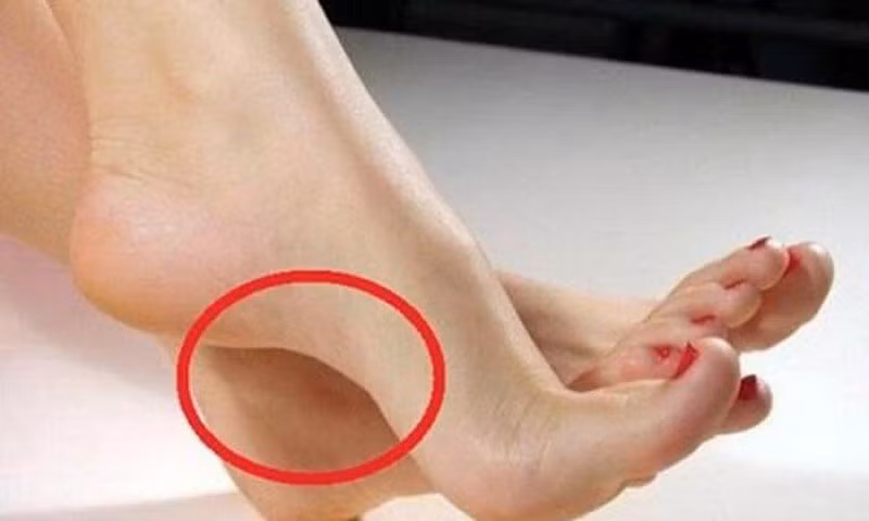 Nhìn tướng bàn chân đoán vận mệnh giàu sang - Hình 3 Nhin tuong ban chan doan van menh giau sang-Hinh-3