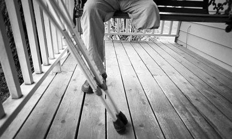 Một cuốn sách về y khoa ghi nhận trường hợp đầu tiên mắc căn bệnh này tại Anh vào năm 1785. Người đàn ông đã dùng súng đe doạ và yêu cầu bác sĩ cắt cụt một chân của mình. Anh ta tin rằng điều này có thể khiến anh thu hút một người phụ nữ cũng bị khuyết tật. Ảnh:Guardian