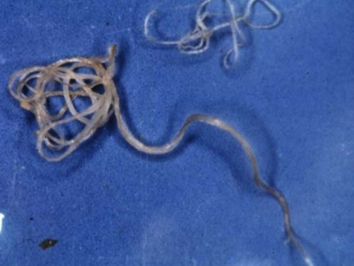 Ký sinh trùng giun Filarial có hình tròn, nhỏ như sợi chỉ, nhưng có sức mạnh đáng sợ vô cùng. Chúng ẩn sâu dưới da, khiến nạn nhân phát ban, sẩn mày đay, và viêm khớp, thậm chí có thể mù mắt.