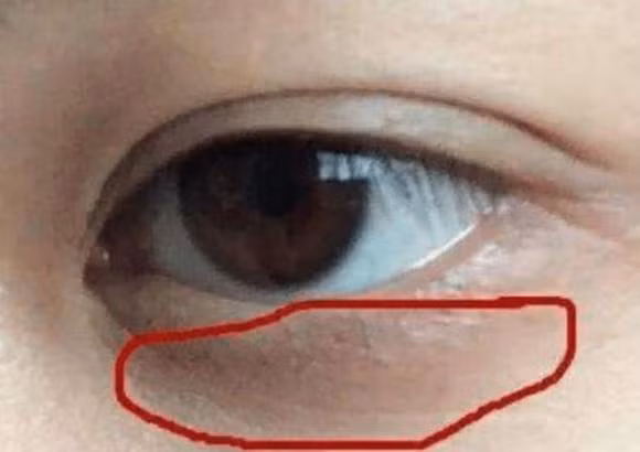 Dan ong than yeu the hien tren guong mat-Hinh-2