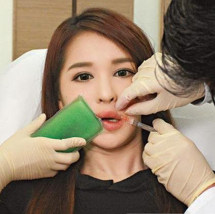 Ở một số trường hợp, khách hàng sẽ được chỉnh hình môi trong quá trình bơm.