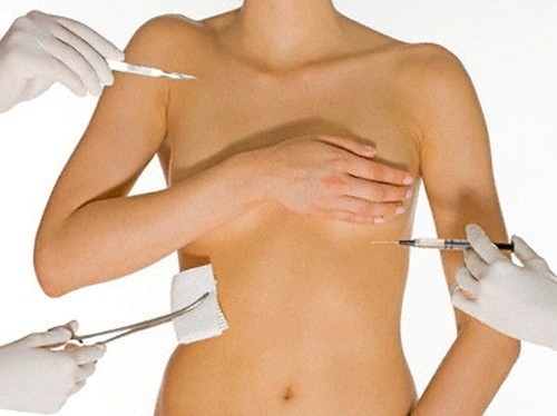 Nâng ngực không phẫu thuật bằng filler. Nâng ngực bằng filler là cách đưa chất lỏng qua một đầu kim siêu nhỏ ,không gây đau đau đớn ,không cần gây mê ,không để lại sẹo và bạn có thể phục hồi sinh hoạt bình thường sau khi thủ tục kết thúc. Cái đặt ra của phương pháp nâng ngực bằng filler là bạn phải tiêm bổ sung theo chỉ định của bác sĩ để đạt hiệu quả thẩm mỹ cao nhất.