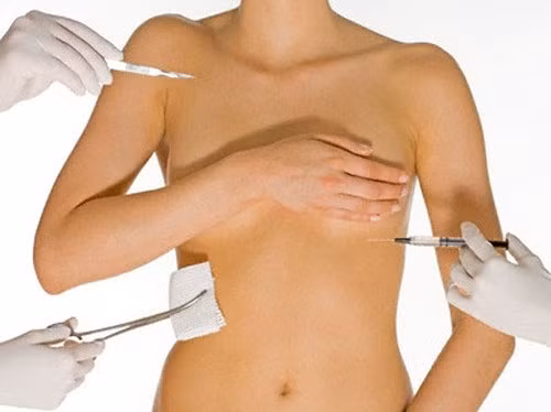 Nâng ngực không phẫu thuật bằng filler. Nâng ngực bằng filler là cách đưa chất lỏng qua một đầu kim siêu nhỏ ,không gây đau đau đớn ,không cần gây mê ,không để lại sẹo và bạn có thể phục hồi sinh hoạt bình thường sau khi thủ tục kết thúc. Cái đặt ra của phương pháp nâng ngực bằng filler là bạn phải tiêm bổ sung theo chỉ định của bác sĩ để đạt hiệu quả thẩm mỹ cao nhất.