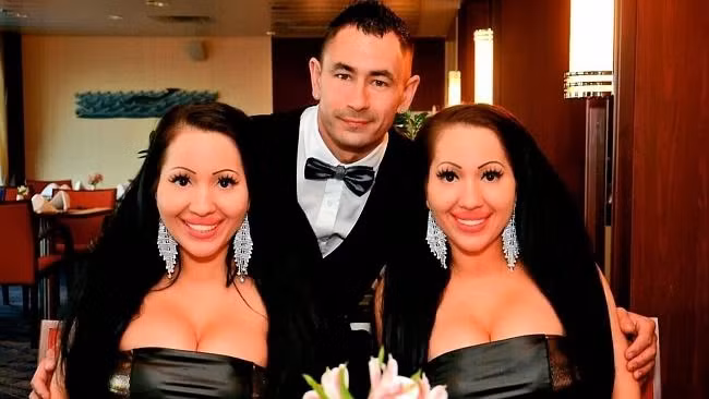 Ở một trường hợp khác, chị em sinh đôi Lucy và Anna DeCinque đã chi hơn 240.800 đô la Úc (khoảng 4,6 tỷ đồng) để sửa sang sắc đẹp.