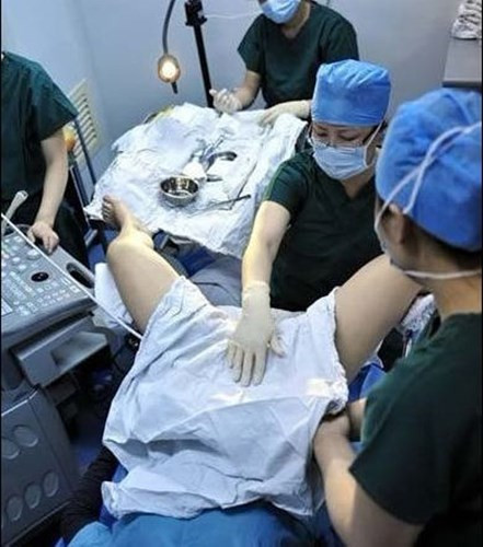 Tiêm thuốc để chọc hút trứng (hCG) khi nang noãn đã trưởng thành. Chọc hút trứng khoảng 36 – 40 giờ sau khi tiêm hCG.