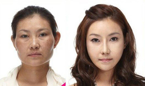 Gọt mặt, làm trẻ hơn nhiều tuổi. Những khuôn mặt trái xoan hoặc có cằm nhọn dài thường làm phụ nữ trẻ hơn gương mặt góc cạnh. Vì thế, không ít người khi gọt mặt, độn cằm nhìn như vừa lấy lại được tuổi thanh xuân.