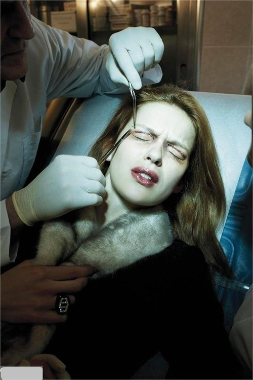 Phẫu thuật cắt mí mắt. Nhiều phụ nữ sẵn sàng chịu đau để thực hiện phẫu thuật nâng mắt và cắt mí để có đôi mắt to, tròn hơn. Chỉ đơn giản là tạo thêm một mí nhưng đôi mắt sẽ có chiều sâu hơn hẳn.