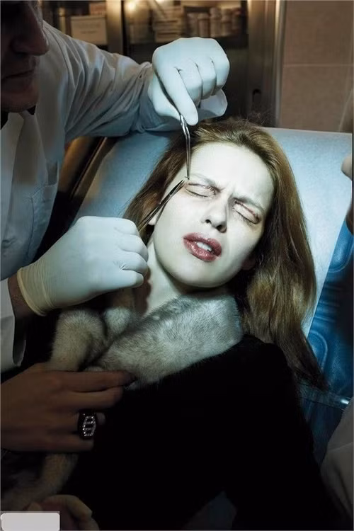 Phẫu thuật cắt mí mắt. Nhiều phụ nữ sẵn sàng chịu đau để thực hiện phẫu thuật nâng mắt và cắt mí để có đôi mắt to, tròn hơn. Chỉ đơn giản là tạo thêm một mí nhưng đôi mắt sẽ có chiều sâu hơn hẳn.