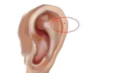 Phu nu co not ruoi o 3 vi tri nay la tuong phu quy