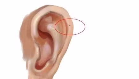 Phu nu co not ruoi o 3 vi tri nay la tuong phu quy