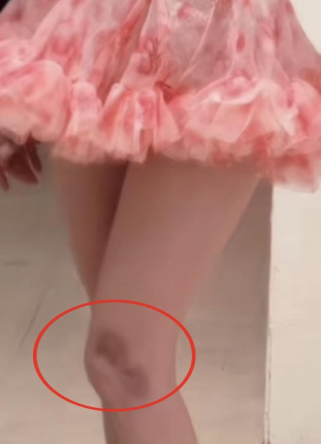 Ngoc Trinh kha binh than don nhan khuyet diem tren co the-Hinh-3