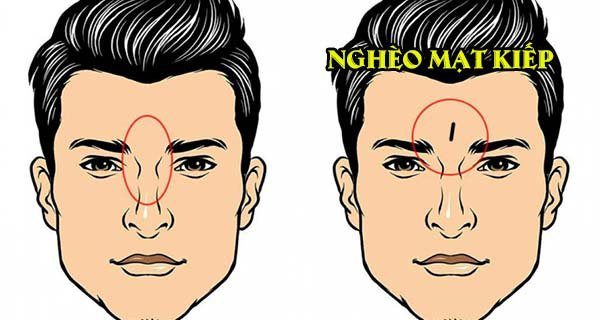 Đàn ông có 1 trong 5 nét tướng này phúc phận khốn khó, có tài vẫn nghèo Dan ong co 1 trong 5 net tuong nay phuc phan khon kho, co tai van ngheo