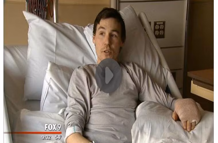 Sạc iPhone nổ, nằm viện hơn tuần. Thay vì trả 25 đến 30 USD cho sạc chính hãng, Tim Tyrell, cư dân Minnesota, Mỹ chỉ mất 10 USD để mua một bộ sạc gồm 2 sạc tường và 1 sạc trên xe cho iPhone qua eBay. Hậu quả là sạc rởm nổ, khiến anh bị bỏng ¼ bàn tay, cộng với một số căn bệnh hiện tại, Tim đã phải trải qua nhiều cuộc phẫu thuật cùng thời gian điều trị trong viện lên tới hơn 1 tuần.