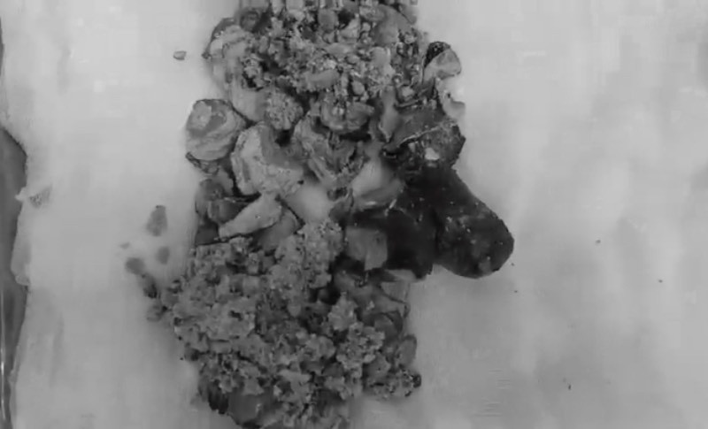 Soi than khong lo dai 20cm sau 50 nam ton tai trong co the-Hinh-2