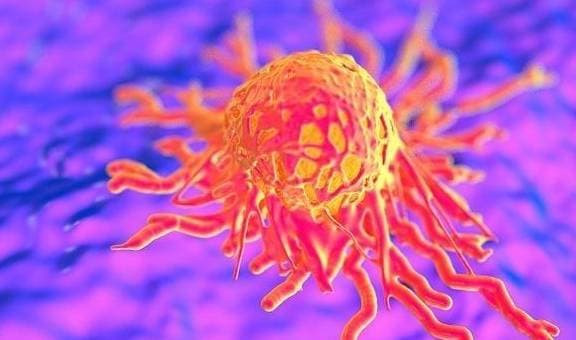 Bo phan nay bi dau, co the te bao ung thu sap thuc giac