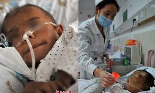 Xiaozhong không thể đi lại, nói chuyện hay ăn uống như những đứa trẻ cùng trang lứa.