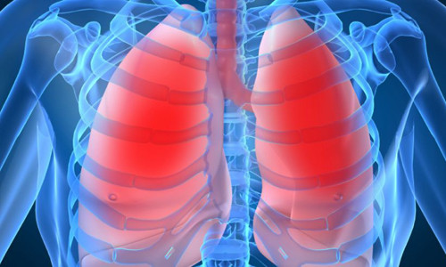 Bảo hiểm, thu nhập, trình độ học vấn ảnh hưởng trực tiếp đến khả năng sống sót của bệnh nhân ung thư phổi.