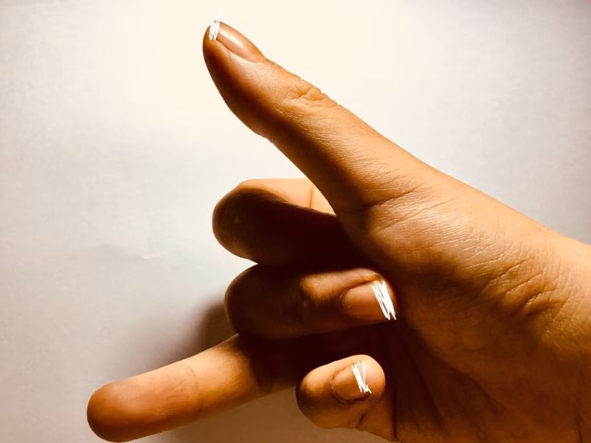 Điều này được các chuyên gia lý giải là do lượng hormone testosterone trong cơ thể vốn dĩ ở mức cao khiến những nam giới này luôn thu hút người khác, nhưng đồng thời có sở thích “cắm sừng” người yêu.