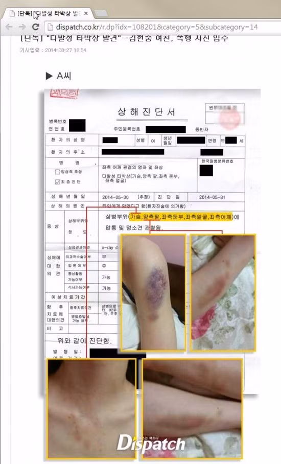 Những bức ảnh và chứng nhận y tế được A gửi tới cảnh sát làm bằng chứng cho việc cô bị người tình Kim Hyun Joong đánh dã man.