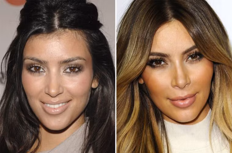 Bơm môi khi đang mang bầu. Đầu năm 2013, Kim đăng một bức ảnh chụp đôi môi cô căng mọng khi đang mang bầu trên Twitter. Cùng lúc, một nguồn tin tiết lộ với tờ Touch, ngôi sao truyền hình thực tế đã bơm môi và tiêm Botox dù đang mang thai.