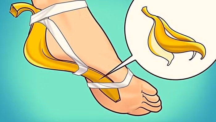 Cha vo chuoi len ban chan ban se bat ngo khi dieu nay xay ra