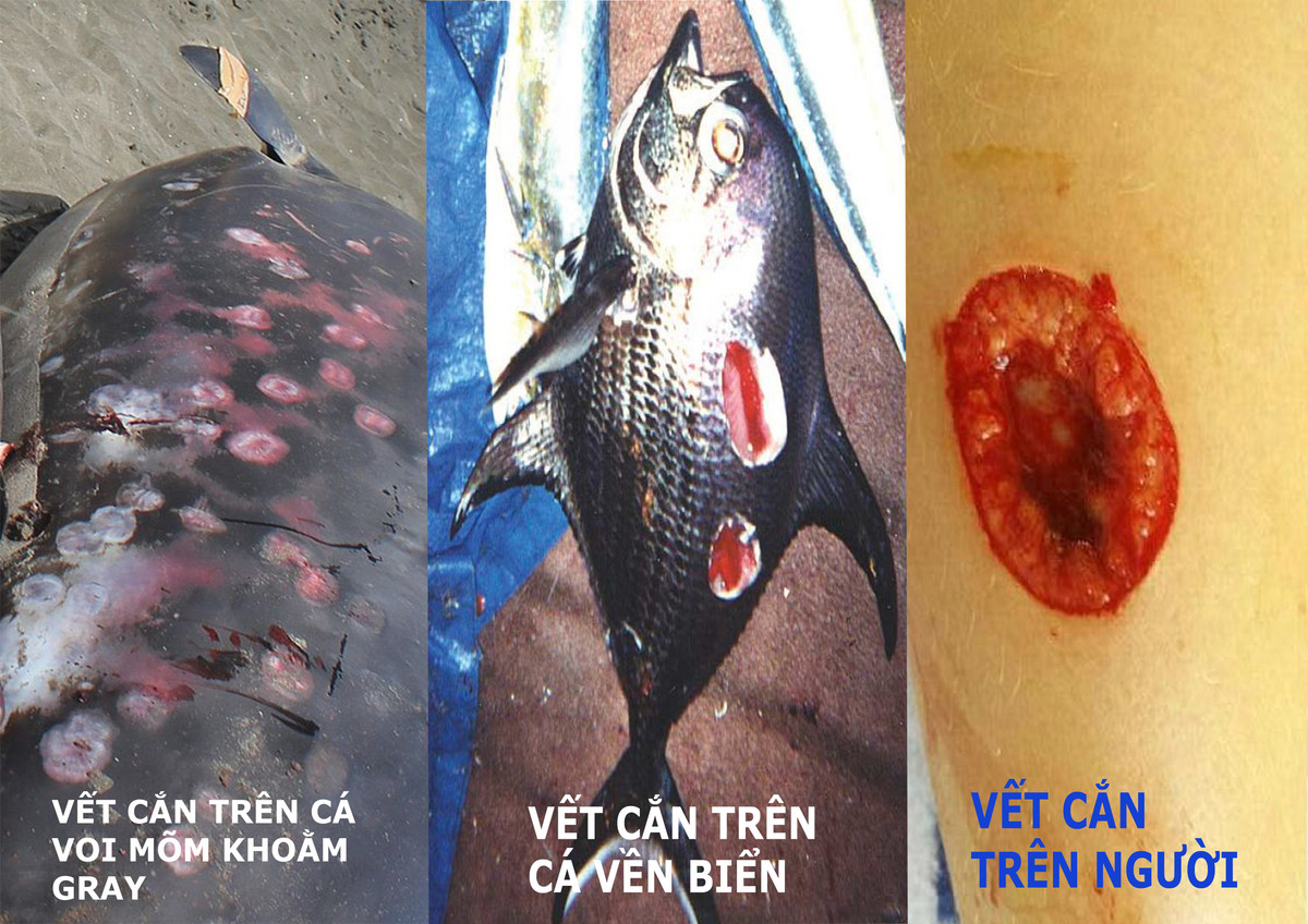 Nguoi dan ong bi 1 sinh vat bi an can vao bung: Loai dang so!-Hinh-2