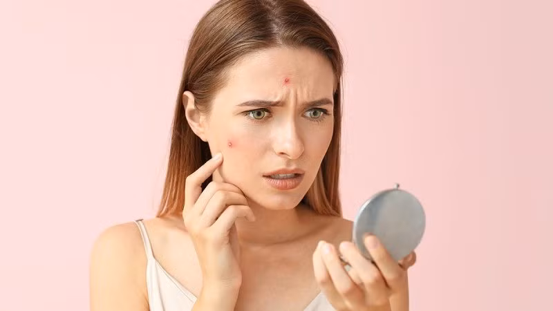 Eat this nhận định bạn nên xem lại chế độ ăn uống khi chăm sóc da kỹ càng nhưng tình trạng mụn vẫn không giảm. Nhiều món ăn, thức uống dưới đây có thể phá hủy làn da. Ảnh: Eat this.