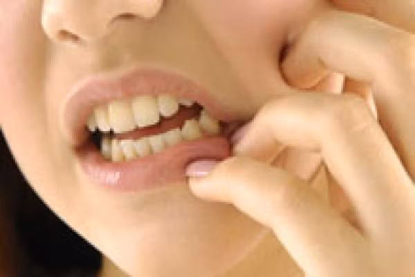 3. Có vấn đề với nướu răng. Viêm, sưng nướu răng hoặc chảy máu là dấu hiệu bạn nên ghé thăm nha sĩ của bạn. Tuy nhiên, nó cũng có thể là một dấu hiệu giai đoạn đầu của một trái tim không khỏe mạnh.